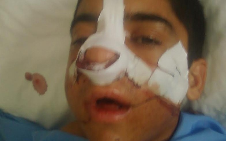 muellim-sagirdini-doyub-olumcul-hala-saldi