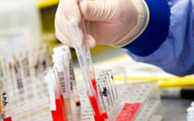azerbaycanda-55-sumuk-iliyi-transplantasiyasi-olub