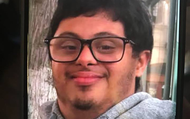 bakida-daun-sindromlu-ereb-turist-itib