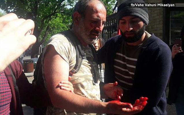 ermenistanda-aksiyaya-qatilan-deputat-xestexanaliq-oldu