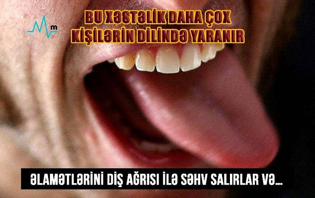 bu-xestelik-daha-cox-kisilerin-dilinde-yaranir