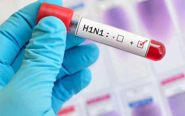 bu-virus-her-kesde-var