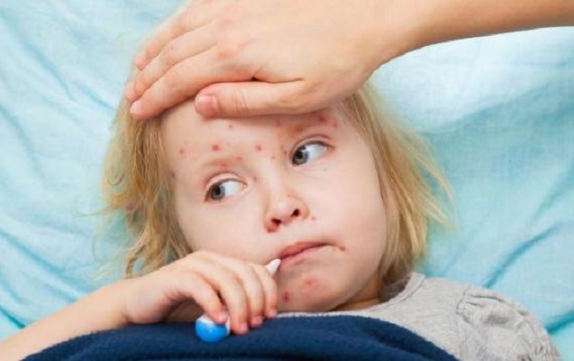 nyu-yorkda-qizilcaya-gore-fovqelade-veziyyet-elan-olundu