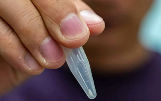 ayagini-kopekbaligi-disledi-24-il-sonra-bildi