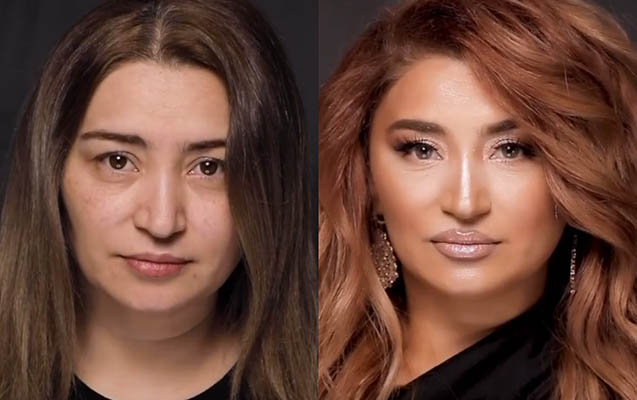 fedaye-lacin-iller-sonra-deyisdi