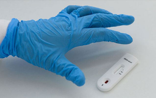 dunya-uzre-koronavirus-xestelerinin-sayi-2-milyon-200-mini-otdu