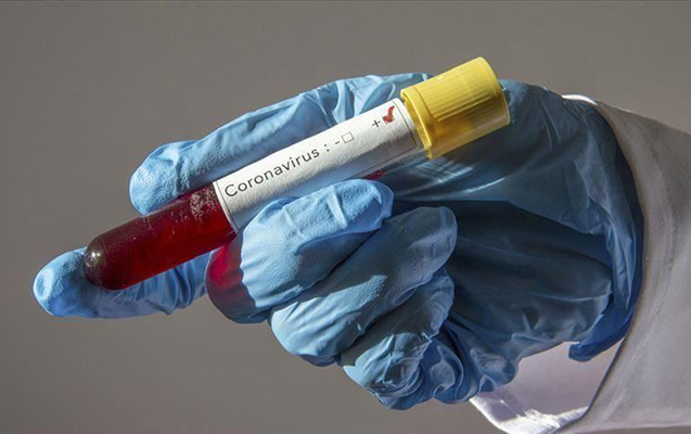 Azərbaycanda daha 38 nəfərdə koronavirus aşkarlandı - 42 nəfər sağaldı