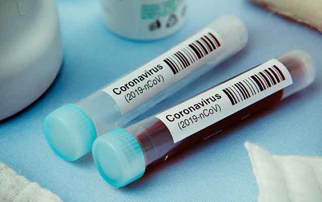 Azərbaycanda daha 76 nəfərdə koronavirus aşkarlandı - 28 nəfər sağaldı