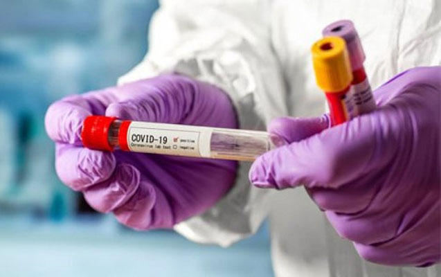 zeytun-pharmaceuticals-sirketi-sehiyye-nazirliyine-temennasiz-50-000-pzr-koronavirus-test-desti-teqdim-etdi