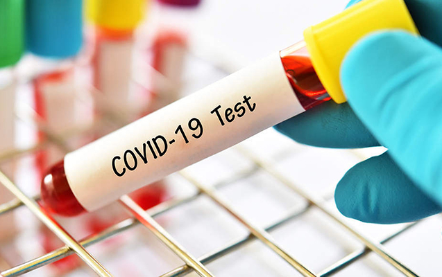 bakida-koronavirus-testi-neqativ-cixdi-pozitiv-teqdim-etdiler