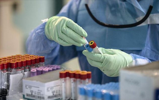 dunyada-koronavirusa-yoluxanlarin-sayi-17-milyonu-otdu