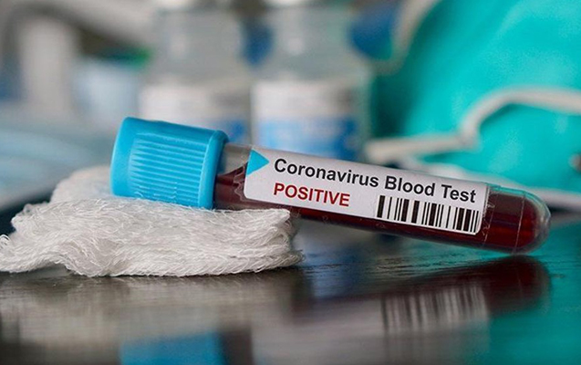 Azərbaycanda 352 nəfərdə koronavirus aşkarlandı - 13 nəfər vəfat etdi