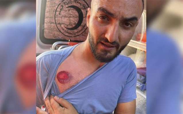 israil-felestin-qarsidurmasinda-turkiyeli-jurnalist-yaralandi
