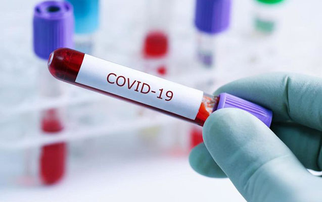 Dövlət büdcəsində COVID-19-la bağlı risklər açıqlandı