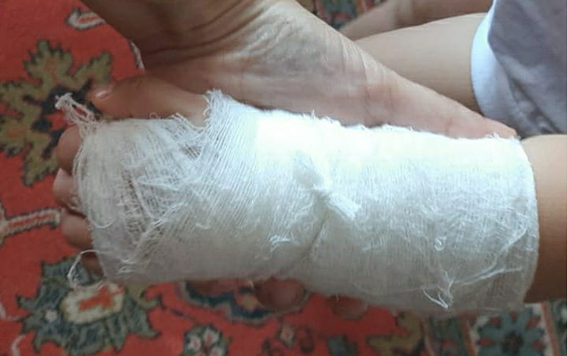 yixilan-qizima-ne-tecili-yardim-cagirilib-ne-agrikesici-verilib