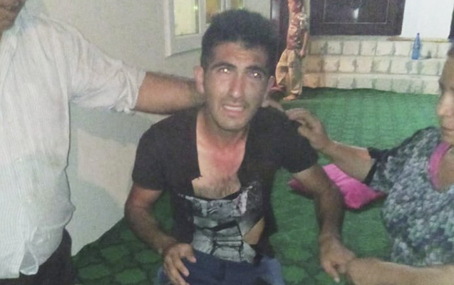 qara-maskali-sexs-mene-iyne-vurmaga-calisanda-qisqirdim-qacdi