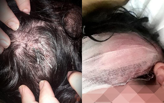 daha-bir-qadina-qarsi-zorakiliq-basina-yeddi-tikis-qoyulub