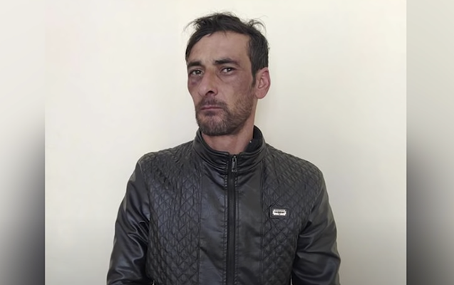 qayinlarini-hebs-etdirmek-ucun-oz-barmagini-kesdi