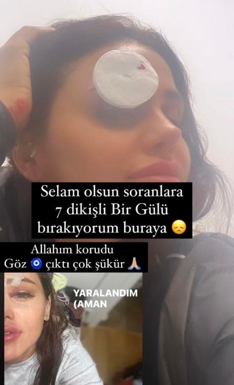 Xanım müğənninin başına iş gəldi - FOTO