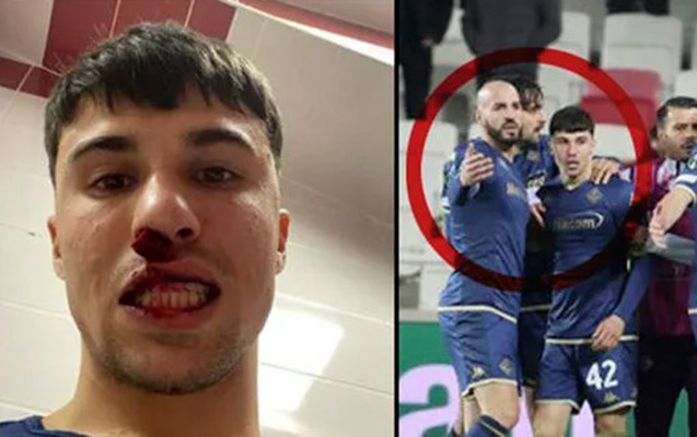 sivasli-azarkesler-fiorentinanin-futbolcusunun-burnunu-qirdi