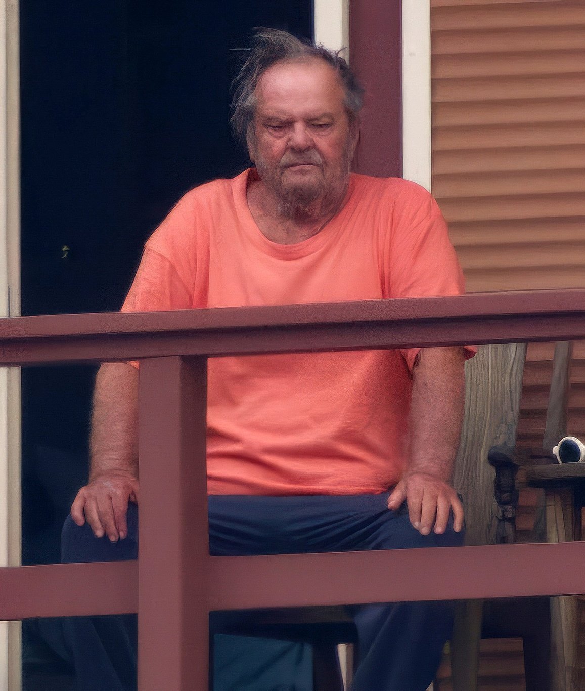 Psixoloji problemləri olduğu deyilən məşhur tanınmaz halda - FOTO