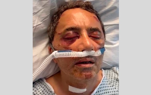 ehmed-obali-ve-oglunu-abs-de-olumcul-doyduler