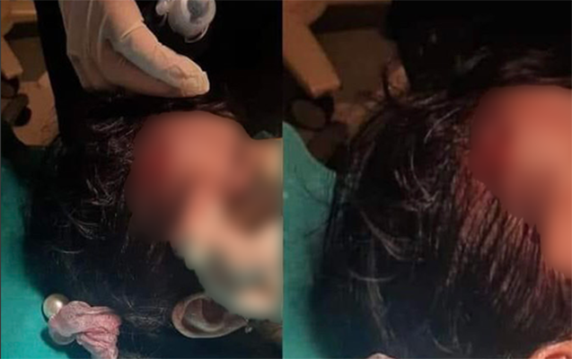 Mingəçevirdə azyaşlını skuter vurdu — Foto