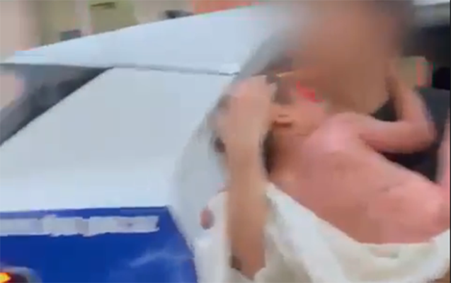 yanan-usagi-xestexanaya-polis-catdirdi