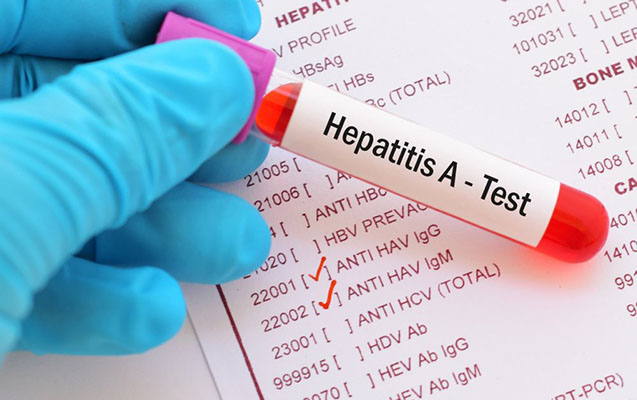 nazirlik-hepatit-a-virusu-ile-bagli-melumat-yaydi