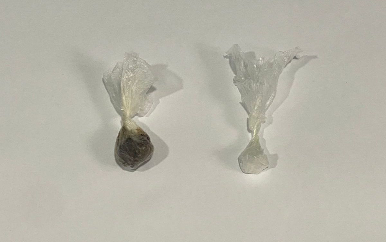 Həbsdəki həyat yoldaşına gödəkçənin cibində narkotik göndərdi  - Fotolar  