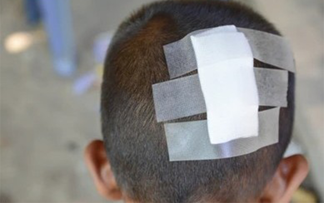 Hesaba görə kafe sahibi ilə mübahisədə - 6 yaşlı oğlu başından zərbə aldı