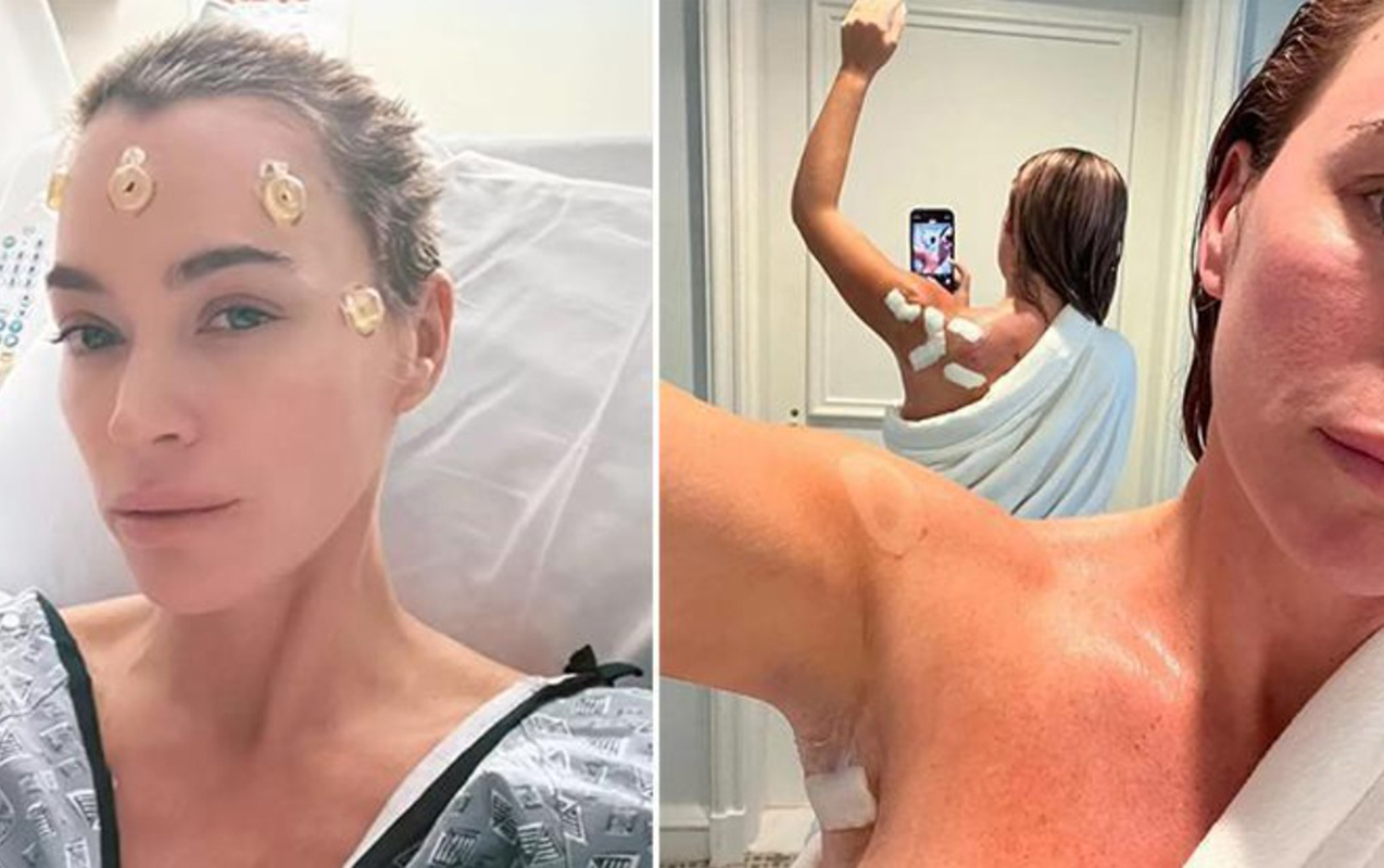 Məşhur aktrisa xərçəngə qalib gəldi - “Mübarizə lazımdır”