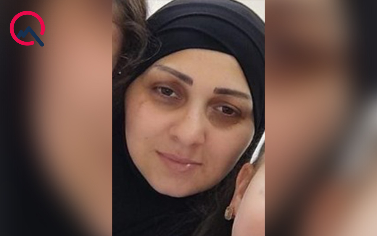 31-yasli-qadin-26-gundur-tapilmir