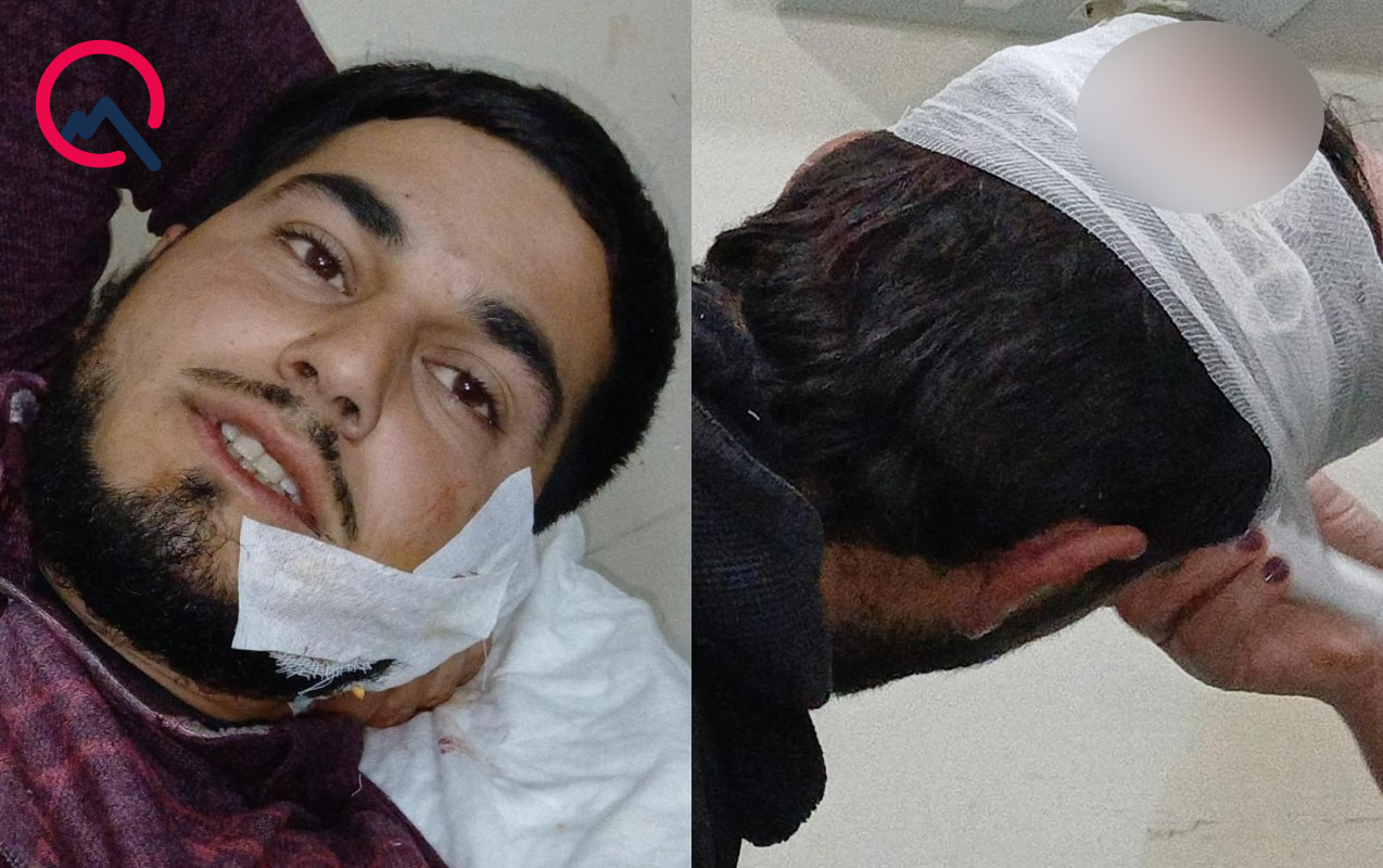 agdamda-2-qardas-12-manata-gore-bicaqlandi