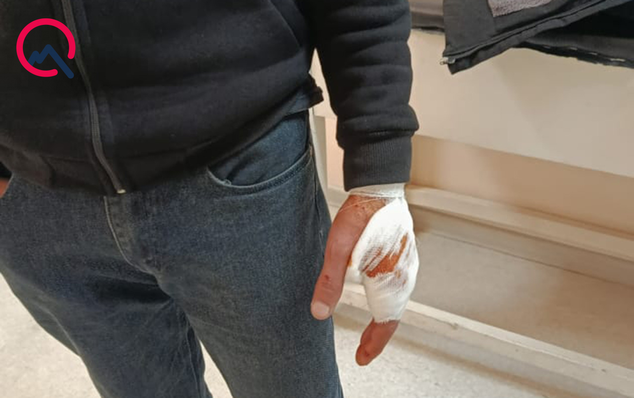 sekide-canavar-kende-hucum-etdi