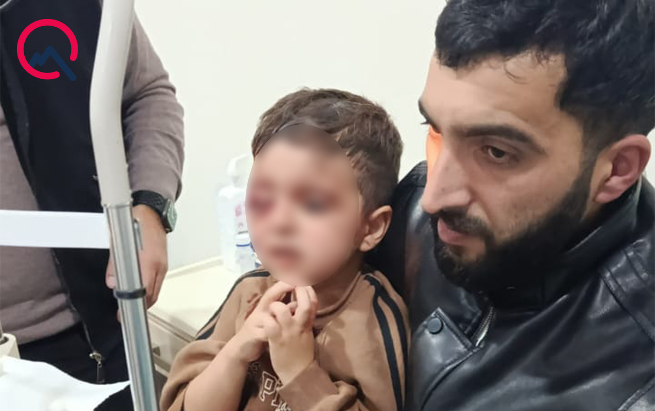 canavar-hucumuna-meruz-qalan-sexslerin-veziyyeti