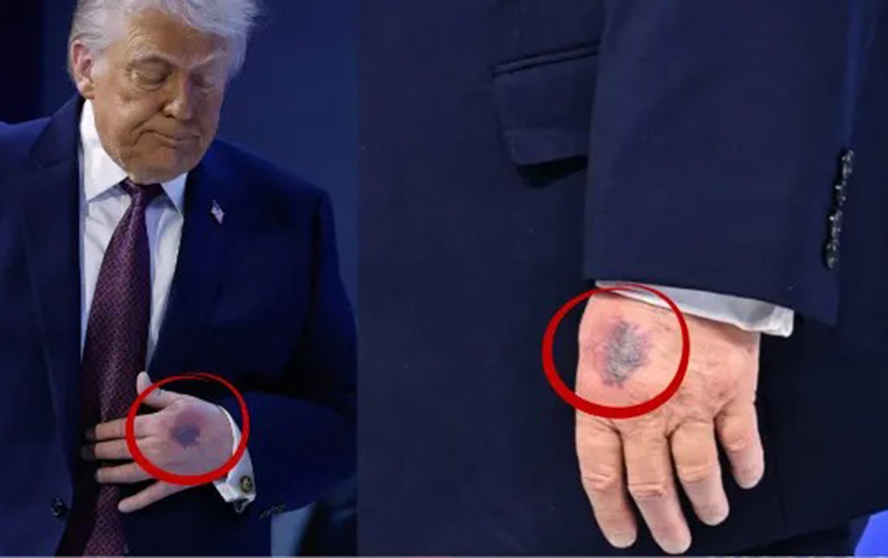 yene-elleri-ile-gundem-oldu