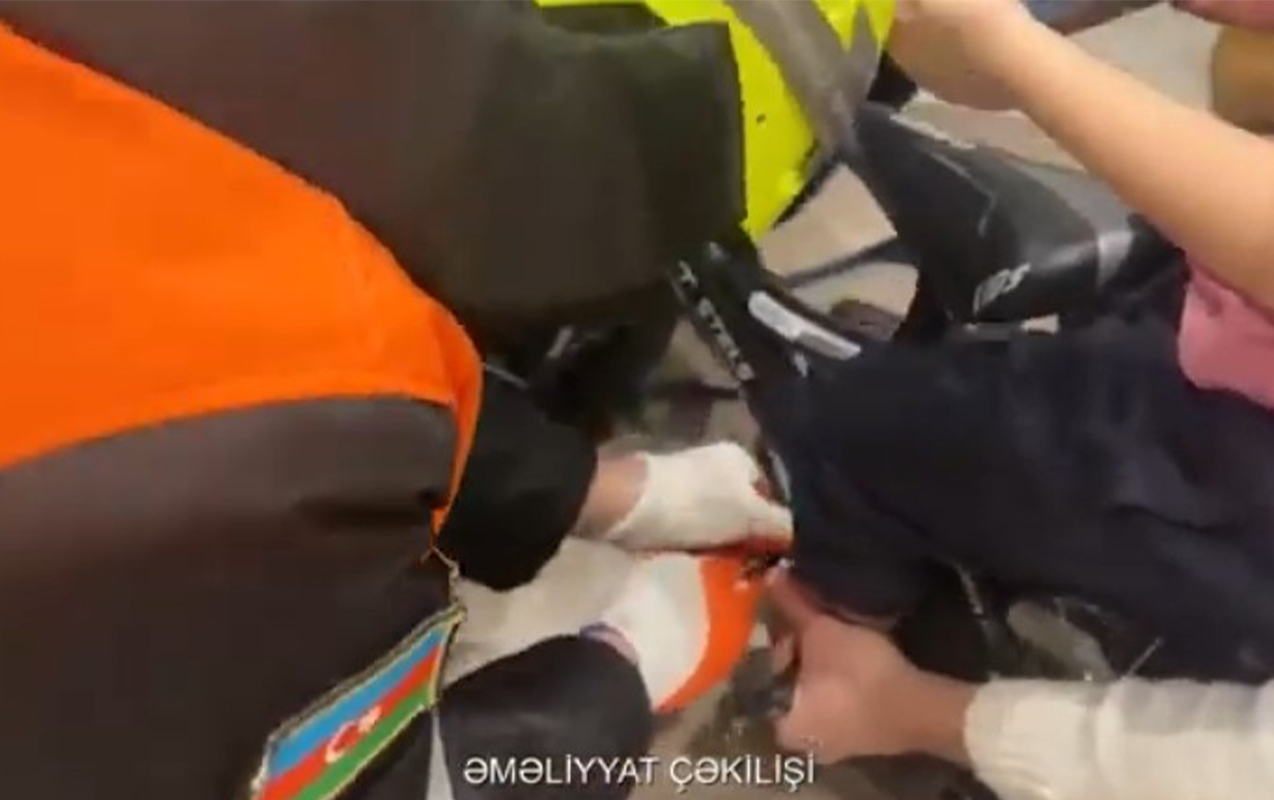 4-yasli-usagin-ayagi-velosipedin-pedalina-ilisdi