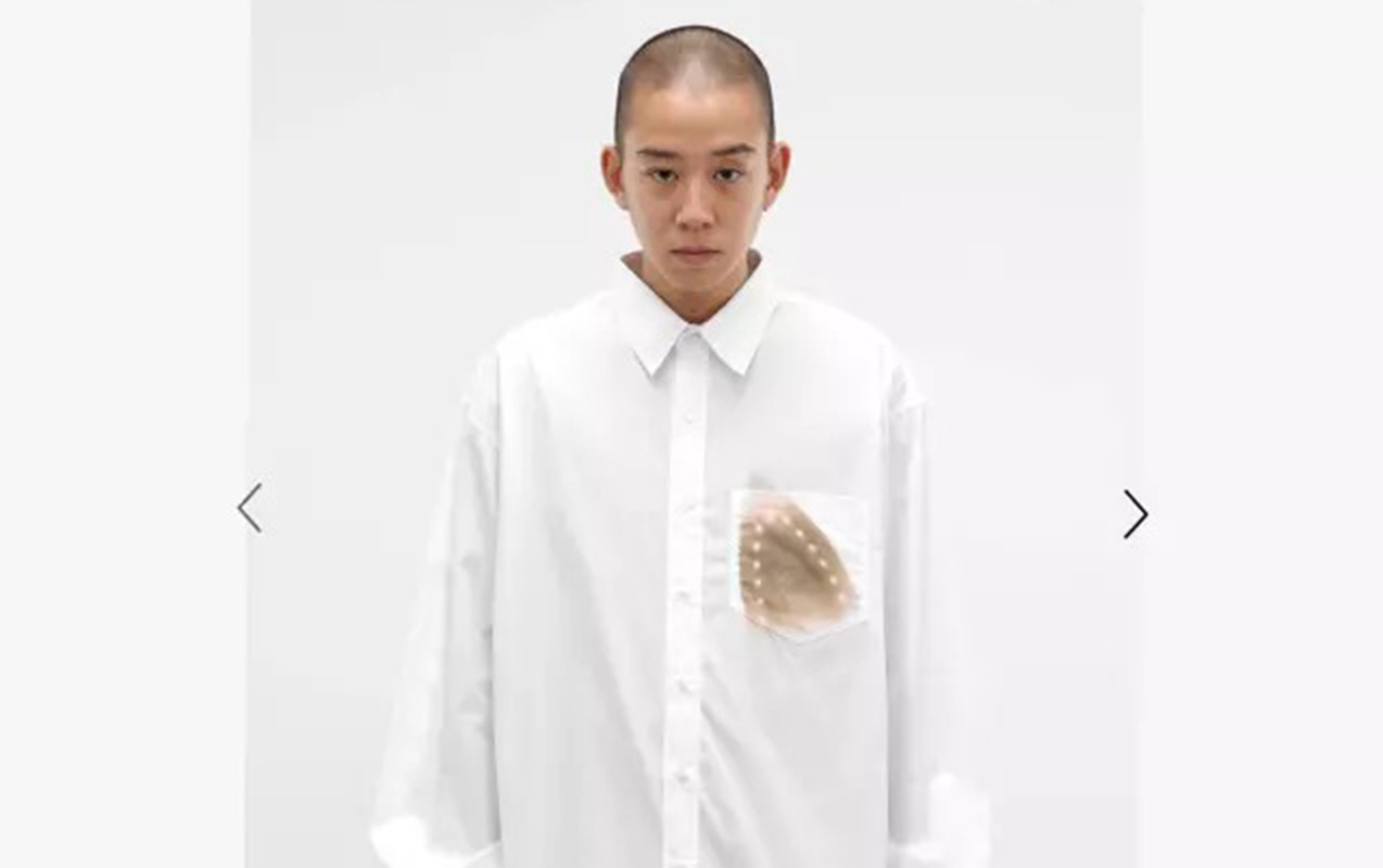 ne-olsun-ki-uzerinde-utu-yanigi-var