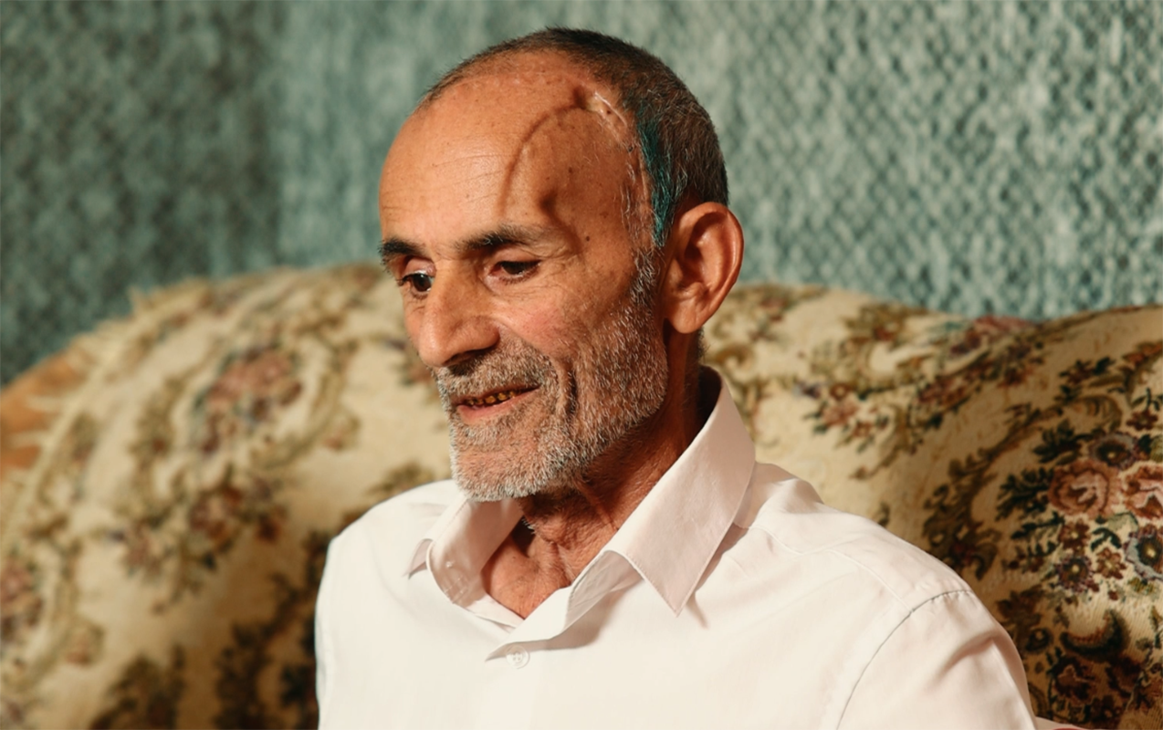 icbari-tibbi-sigorta-ile-beyin-emeliyyati-olundu