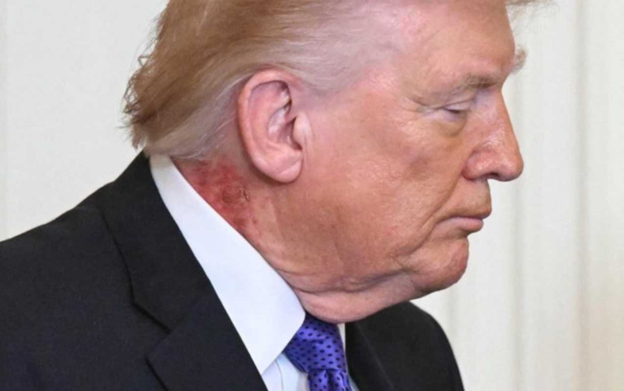 boynundaki-sepgiler-muzakire-yaratdi