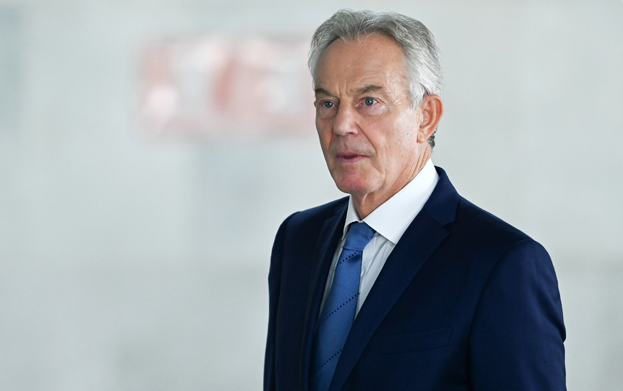 onun-da-adi-epsteyn-qalmaqalinda-hallanir