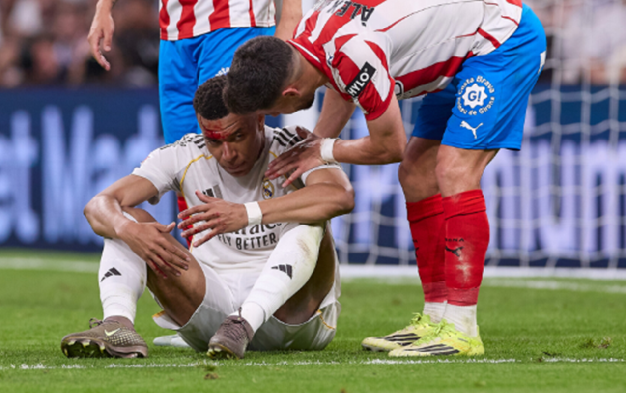 mbappe-zedesine-gore-mesqi-buraxdi