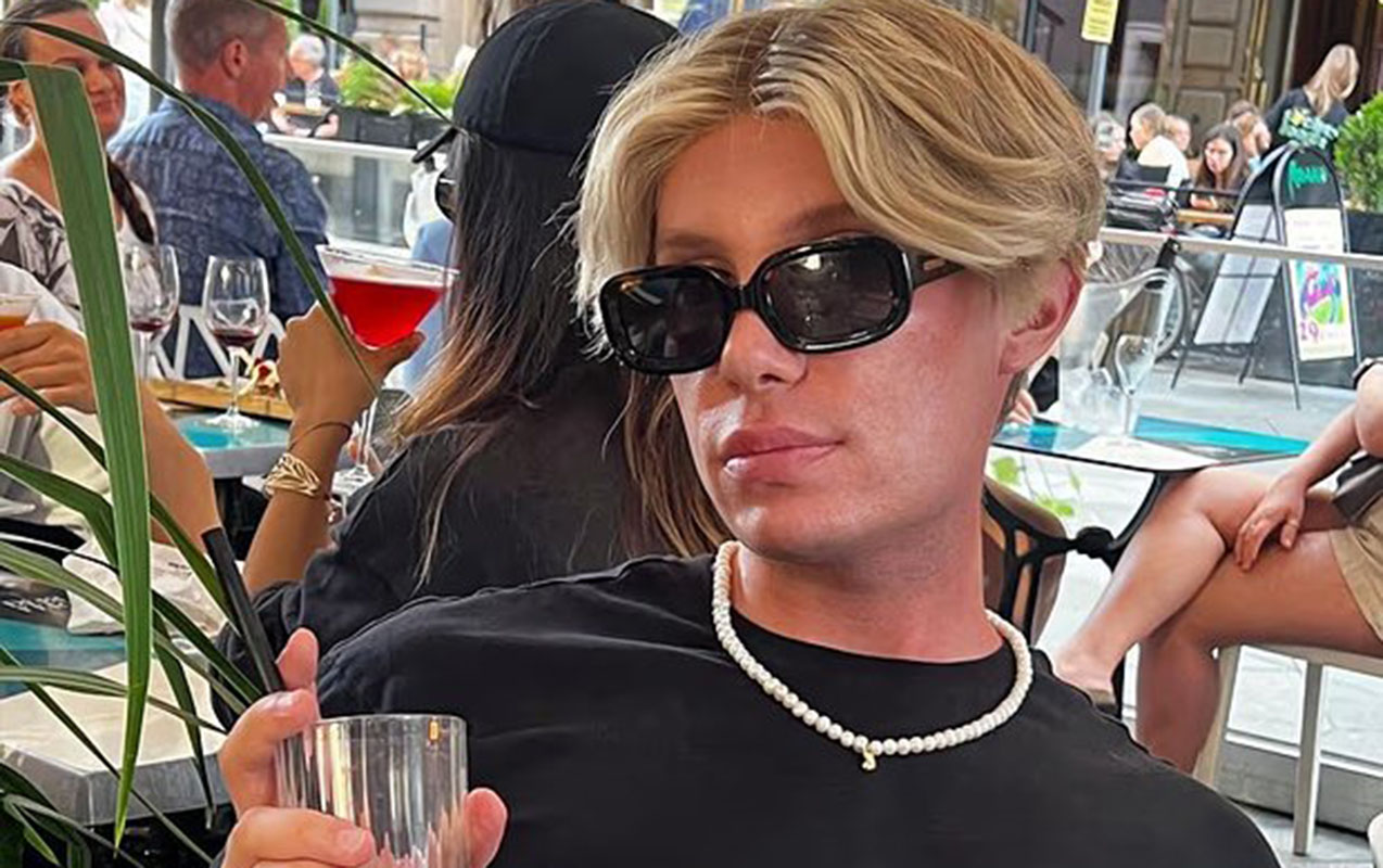 finlandiyali-bloqer-estetik-emeliyyatdan-sonra-gorme-qabiliyyetini-itirdi