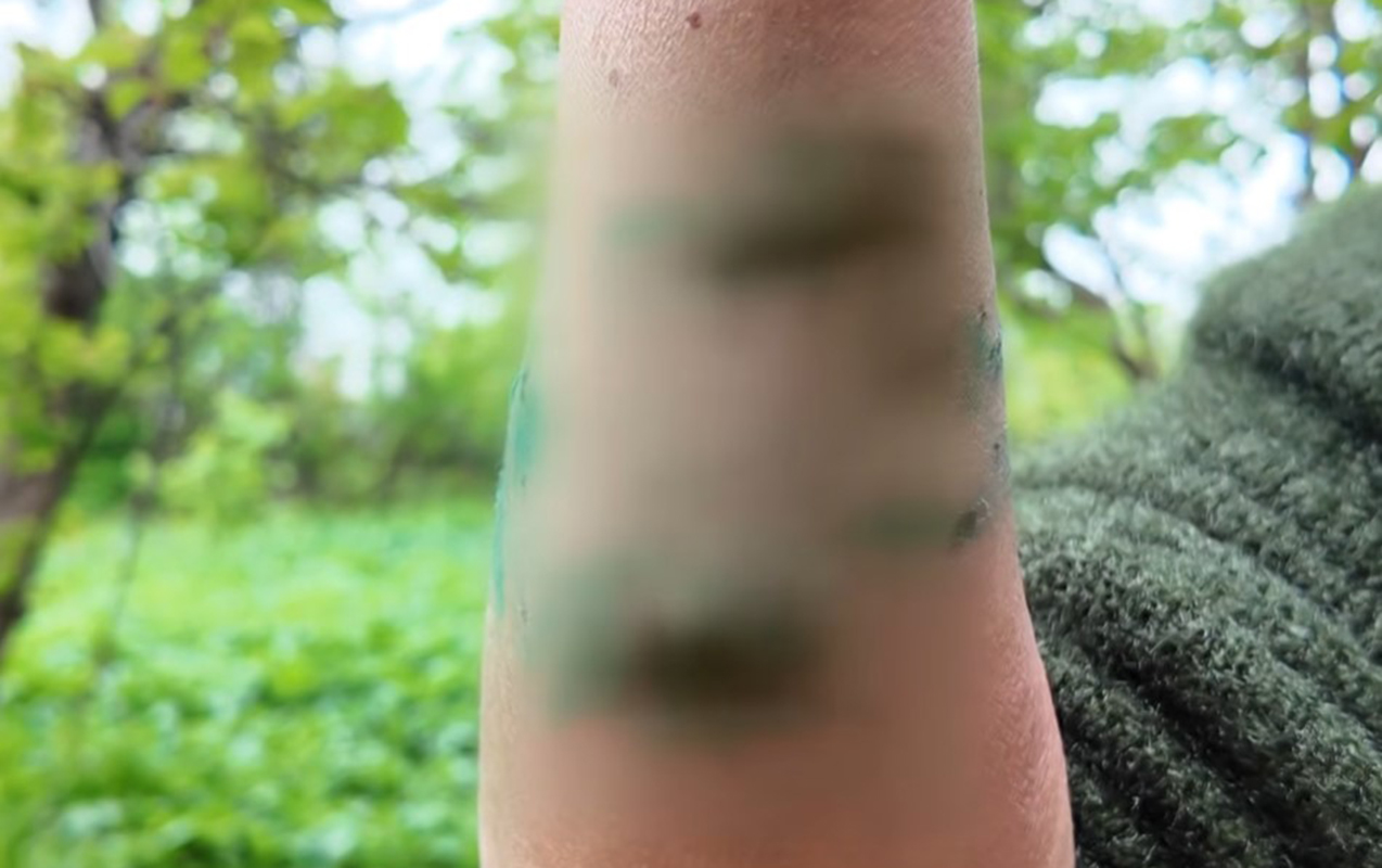 ucarda-caqqal-sakinlere-hucum-etdi-xesaret-alanlar-var