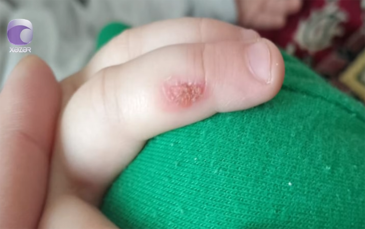 3-yasli-usagim-bagcada-aglayanda-bicagi-qizdiraraq-eline-basib