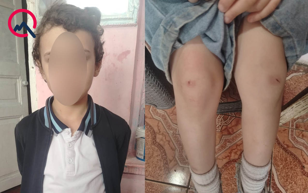 4-cu-sinif-sagirdi-nevemi-mektebin-ayaqyolusunda-doyub