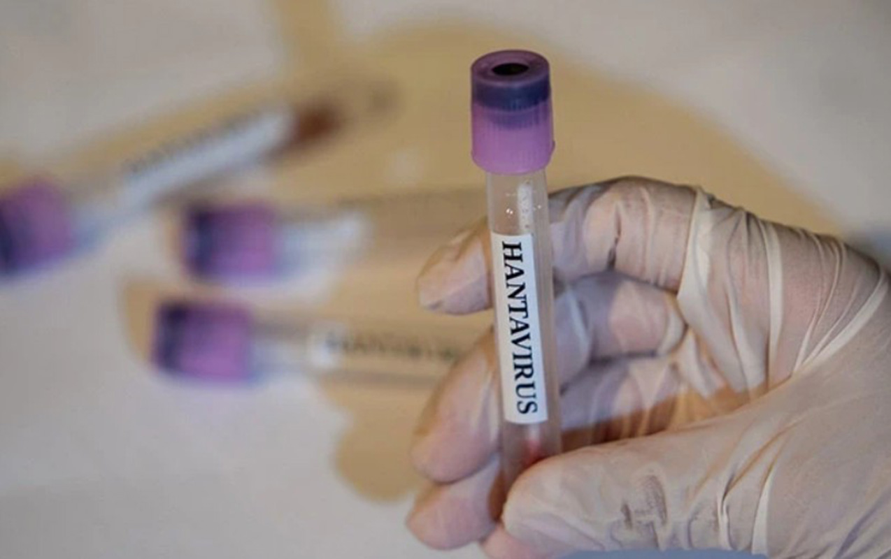 hantavirus-o-olkeye-de-catdi