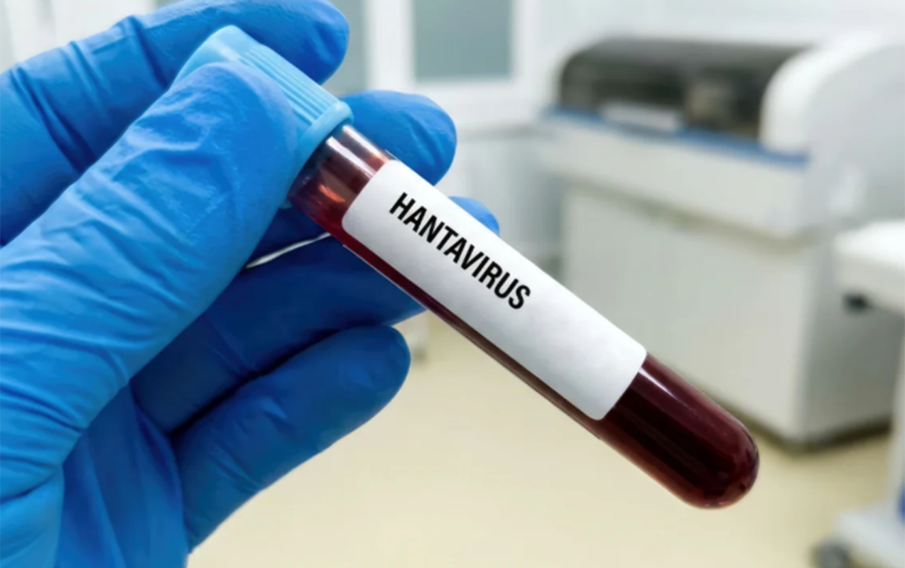 hantavirus-insandan-insana-nadir-halda-kecir