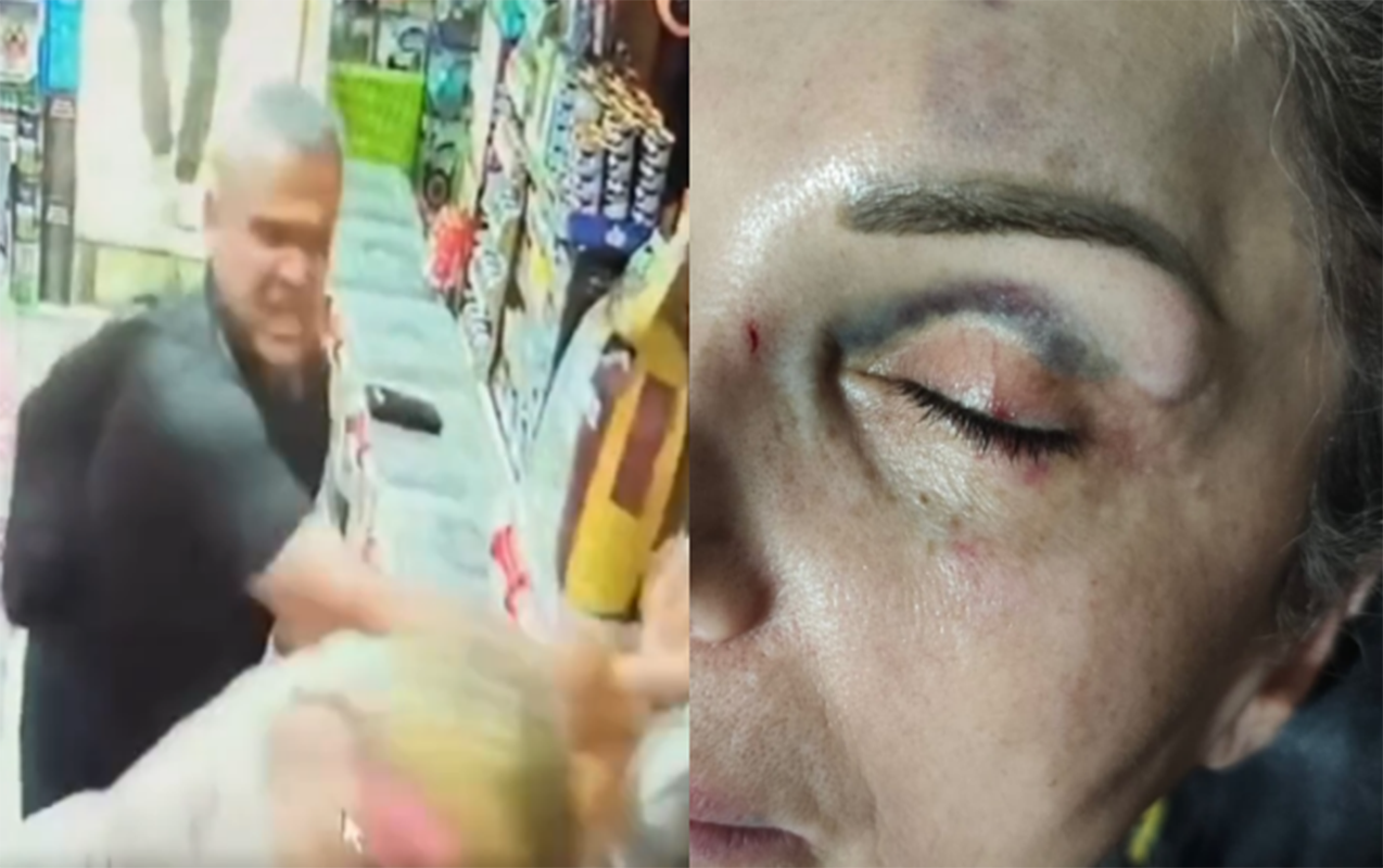 qadini-magazada-doydu
